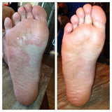 Anti-fungal Foot Cream