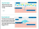 Silicone Scar Removal Patch