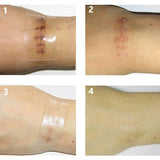 Silicone Scar Removal Patch