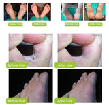 Anti-fungal Foot Cream