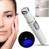 BLUE LIGHT THERAPY - ACNE LASER PEN