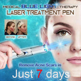 BLUE LIGHT THERAPY - ACNE LASER PEN