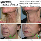 Neck Line Jawline Intense Serum