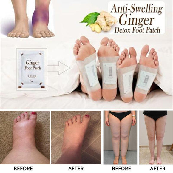 Anti-Swelling Ginger Foot Detox Patch (10 pcs)